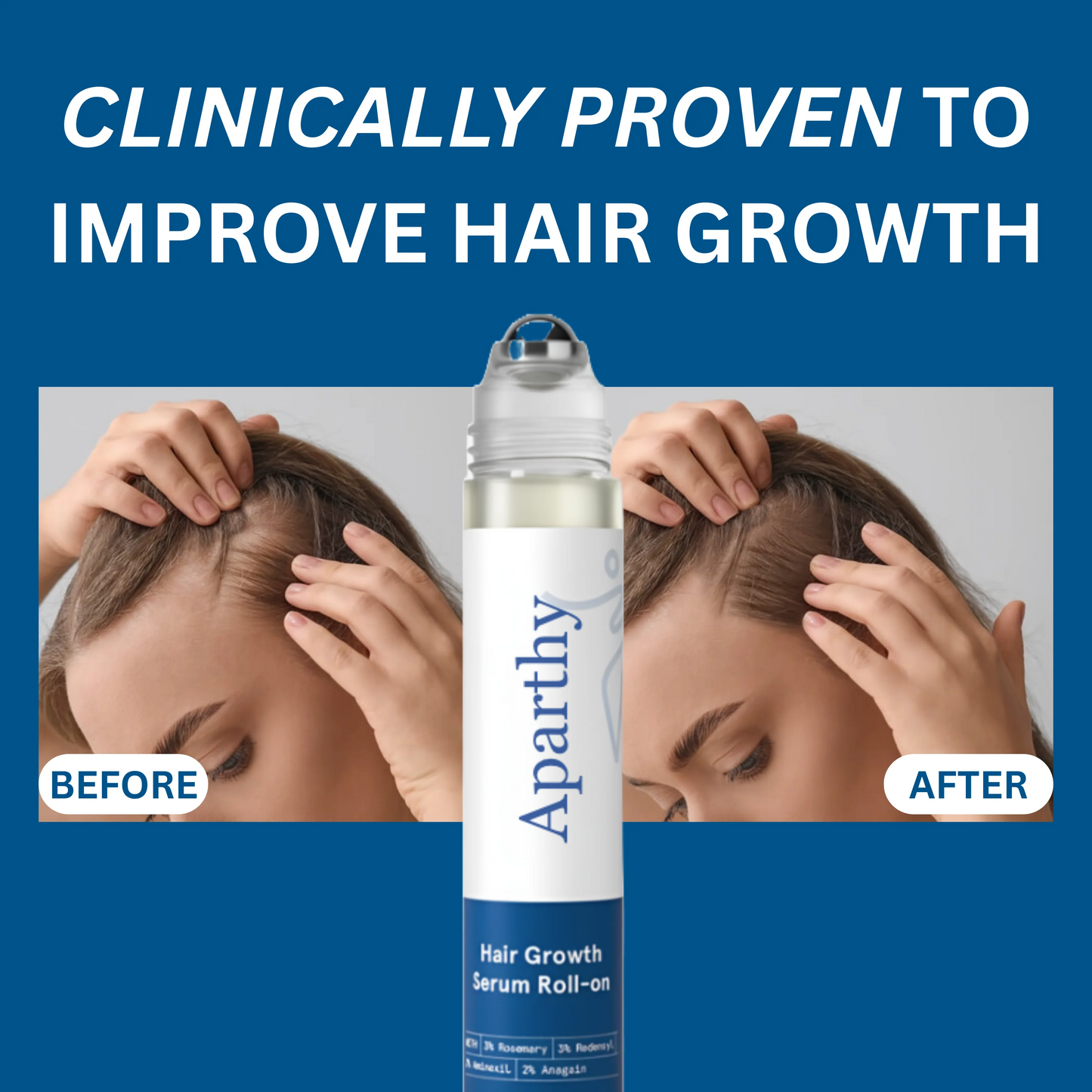 ⚡Last Day 70% OFF丨Advanced Hair Growth Roll-On Serum🔥Buy 1 Get 1 Free Only Today!