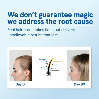 ⚡Last Day 70% OFF丨Advanced Hair Growth Roll-On Serum🔥Buy 1 Get 1 Free Only Today!