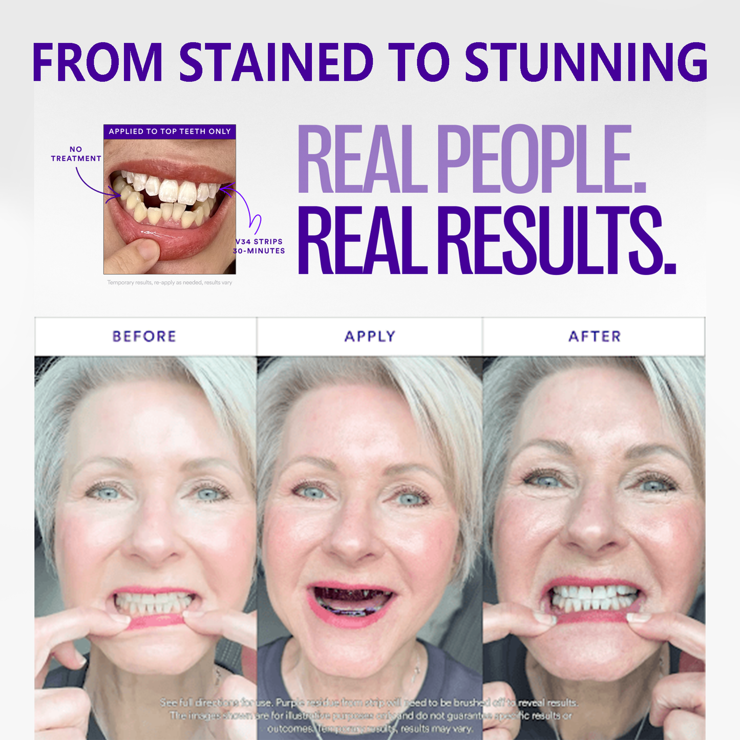 ⚡Last Day 60% OFF丨🦷V34 Whitening Strips – Professional Teeth Whitening at Home