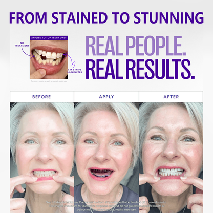 ⚡Last Day 60% OFF丨🦷V34 Whitening Strips – Professional Teeth Whitening at Home