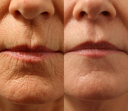 Natravor® Instant Wrinkle-Reducing Natural Cream