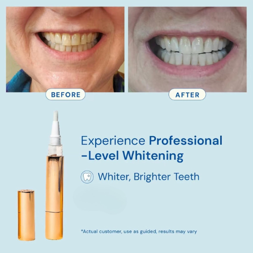 ⚡Last Day Buy 1 Get 1 Free丨💙 Dentist-Recommended Teeth Whitening Pen