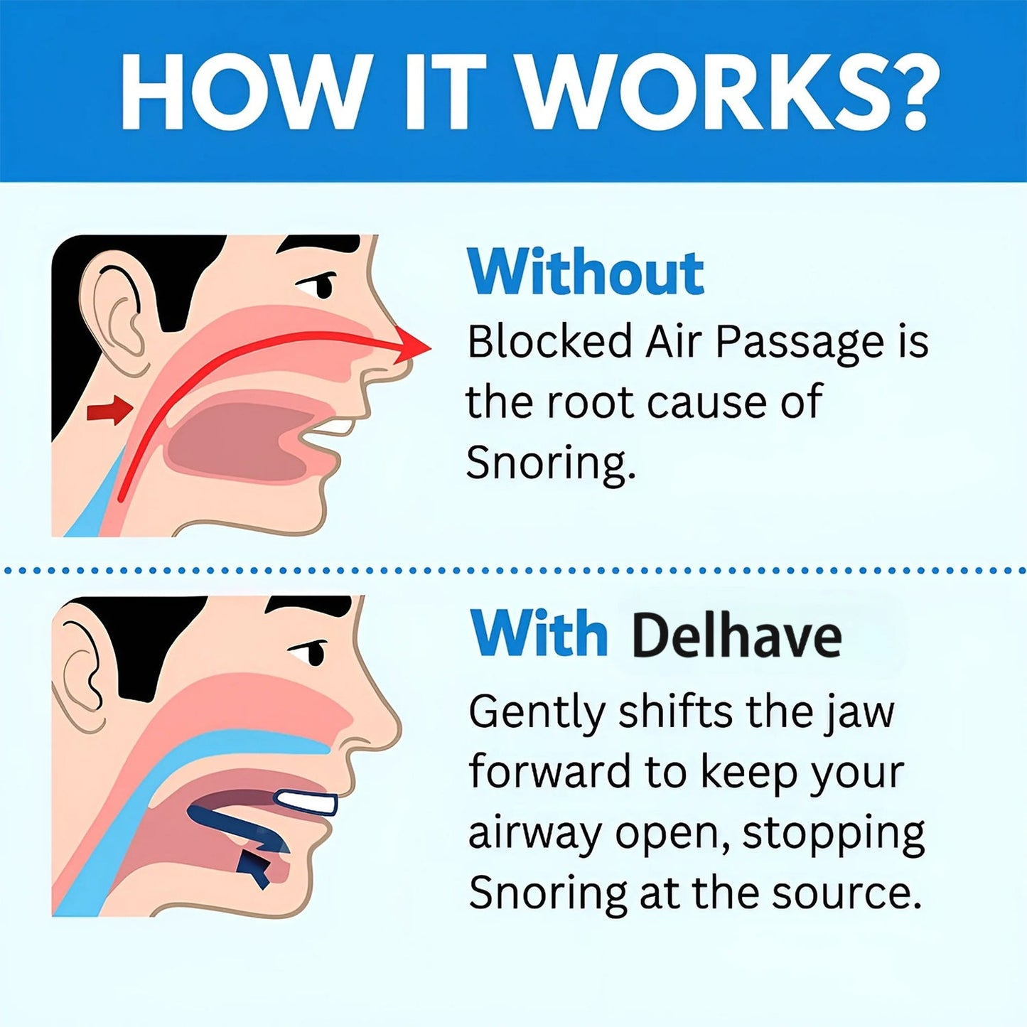 Natravor® The Quiet Anti-Snoring Mouthpiece Universal Size