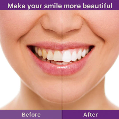 ⚡Last Day 60% OFF丨🦷V34 Whitening Strips – Professional Teeth Whitening at Home