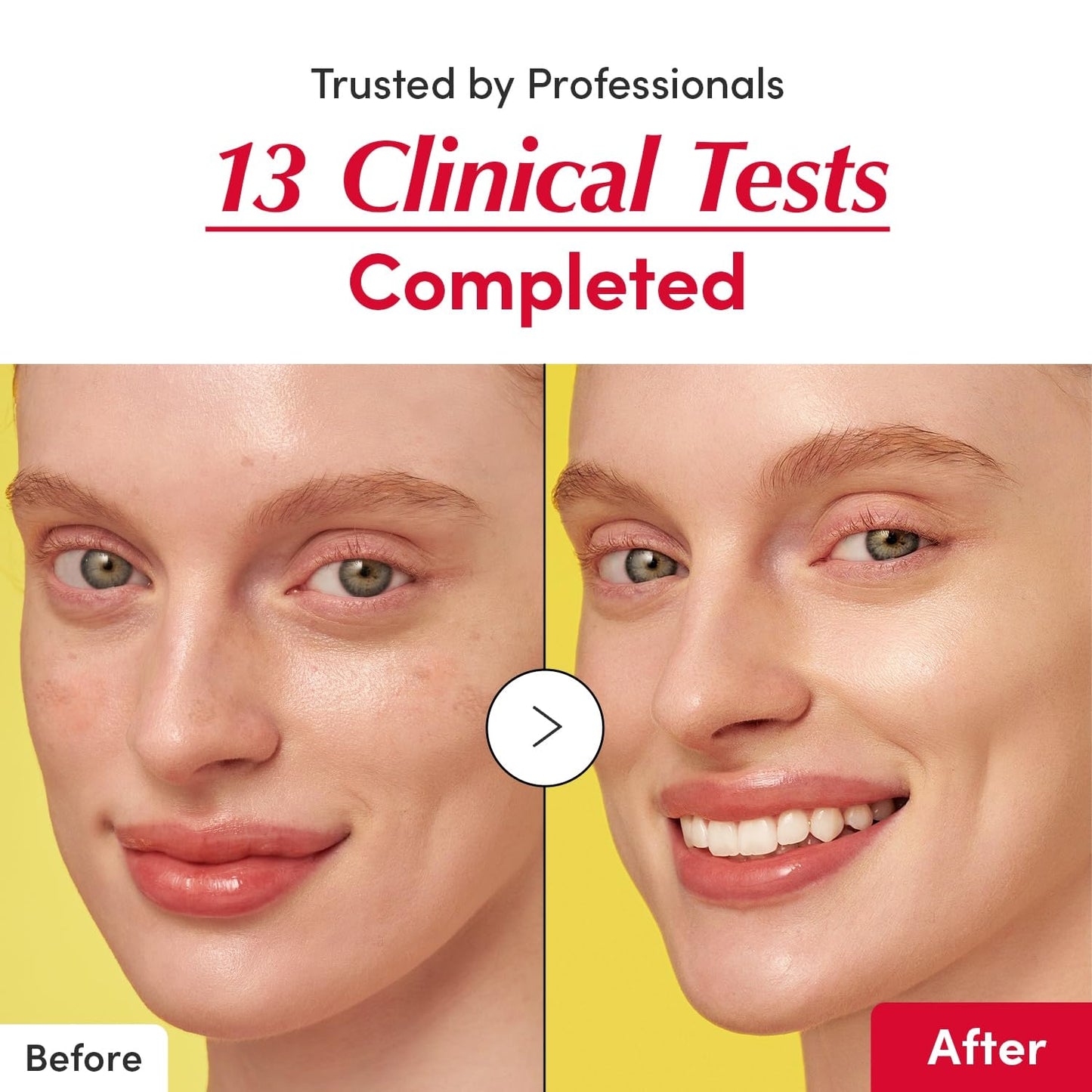 ⚡Last Day 70% OFF丨🦋Korean Skin Care Retinol Serum