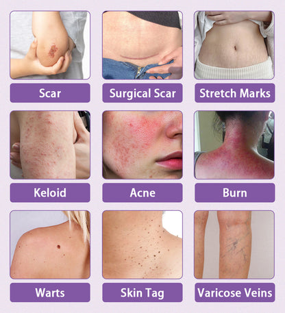 Natravor® Microneedle stretch mark patch