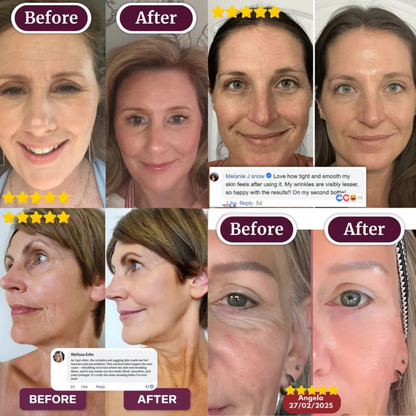 BUY 2 GET 1 FREE🔥Collagen-Calcium Multi Balm