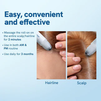 ⚡Last Day 70% OFF丨Advanced Hair Growth Roll-On Serum🔥Buy 1 Get 1 Free Only Today!