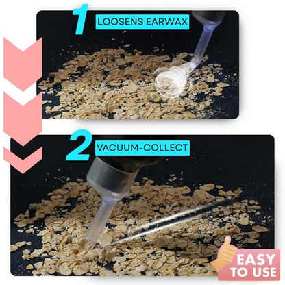 🔥Hot Sale🔥 Earwax Vacuum – Safe & Painless Ear Cleaning for the Whole Family